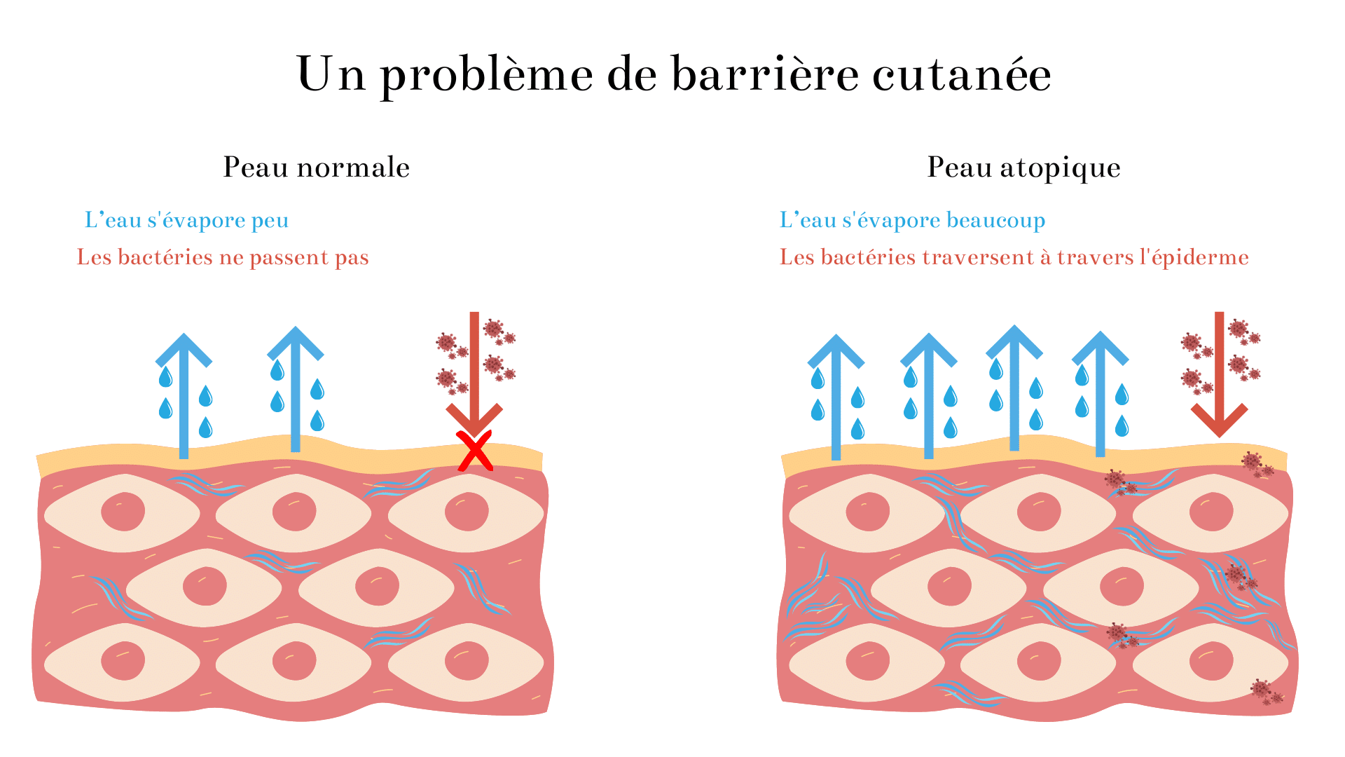 schéma d'un film hydrolipidique d'une peau normal et d'une peau atopique. Le film hydrolipique de la peau normal limite l'évaporation de l'eau des couches de la peau et protège des bactéries et le film hydrolipidique de la peau atopique laisse évaporer plus d'eau et laisse la contamination des bactéries.