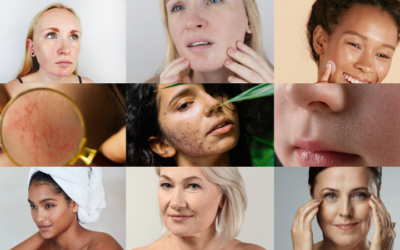 Type de peau et état : comment les reconnaître et en prendre soin ?